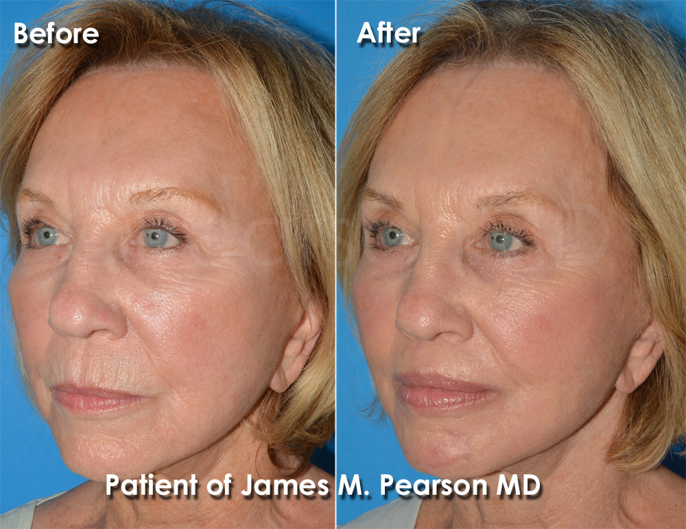 Dr. Pearson Plastic Surgery