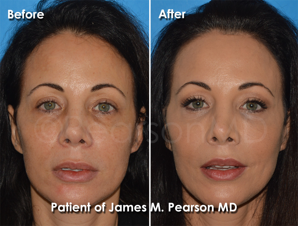 Pearson Cosmetic Surgery